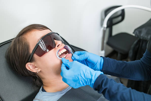 Best Emergency Dentist for Lost Fillings or Crowns in USA